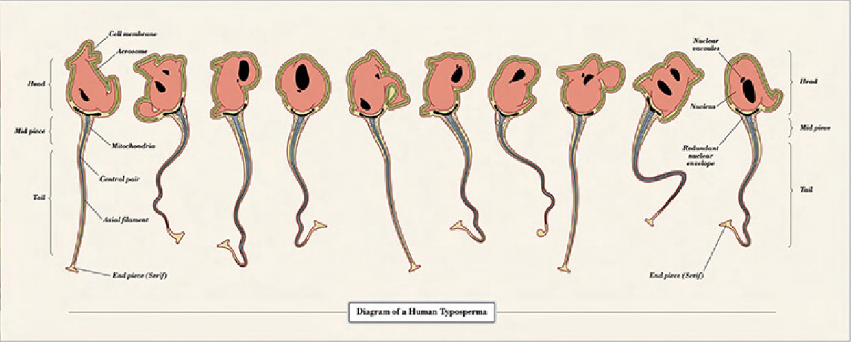 Biotypography: Typosperma